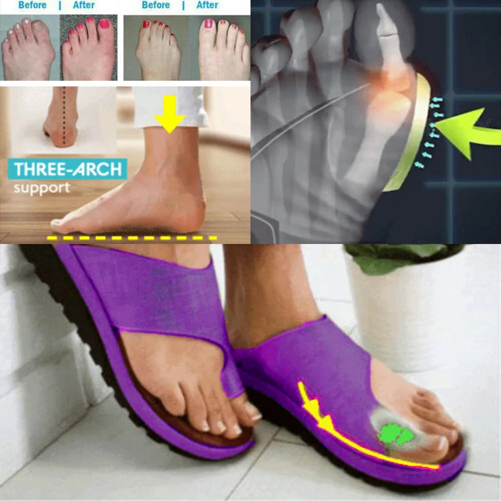 Women Summer Orthopedic Sandals - Comfy Platform Flat Bunion Corrector Slippers | Afrocentric