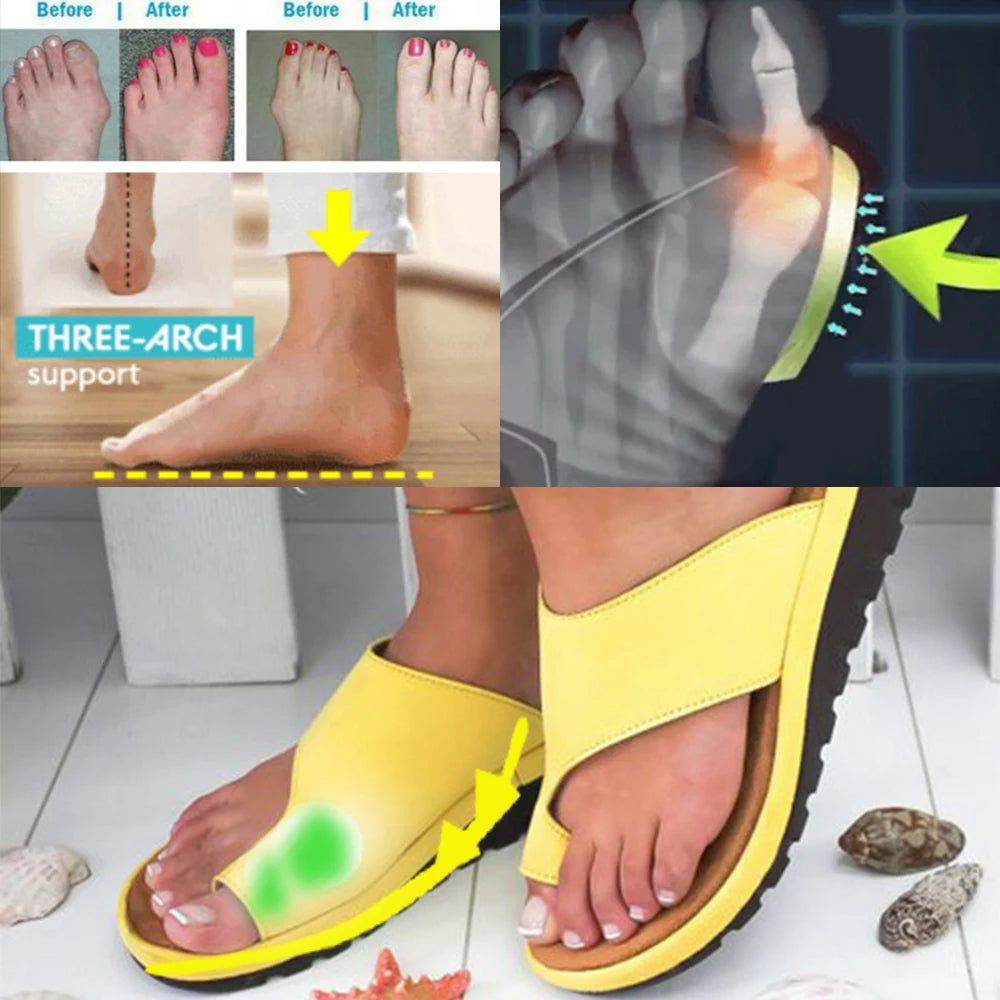 Women Summer Orthopedic Sandals - Comfy Platform Flat Bunion Corrector Slippers | Afrocentric